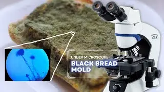 How to watch the Bread Mold/Fungus under the Microscope | Mesmerizing Microscopic Views!