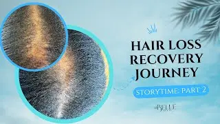 Hair Loss Recovery Journey Storytime: Part 2