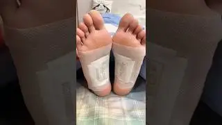 Detox Foot Patches