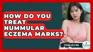 How Do You Treat Nummular Eczema Marks? - Eczema Help Hub