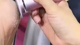 Callosit&eacute; pied