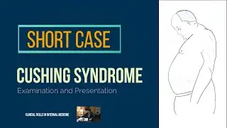 Cushing syndrome