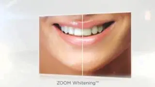 Bellevue Dentist | Family Dentistry | Cosmetic Dental Work Bellevue 98004