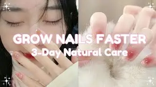 Grow Your Nails Faster in 3 Days 🎀 Natural Nail Care Tips