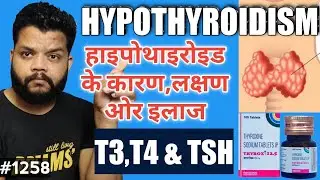 थायरॉइड बढ़ने का कारण ओर इलाज | Hypothyroidism Causes, Symptoms & Treatment In Hindi