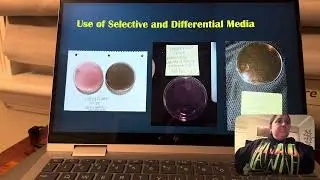 Mock patient Narrated Presentation