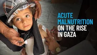 Acute Malnutrition on the Rise in Gaza