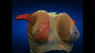 Plastic Surgery Update: Over-50 Facelifts, Laser Hair Removal, New Breast Lift Method