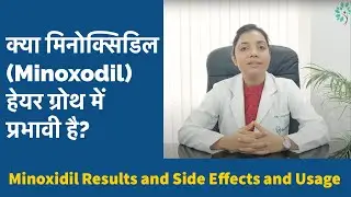 Minoxidil: क्या मिनोक्सिडिल हेयर ग्रोथ में प्रभावी है? जानिए इसके उपयोग, साइड इफेक्ट्स और सावधानियां