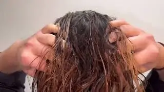 Transform your scalp game with this must-try treatment! #octolyfamily