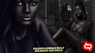 Bukti Cantik Gak Harus Putih.!! Super Model dengan Keunikan Warna Kulit yg Sukses Gebrak Dunia Mode