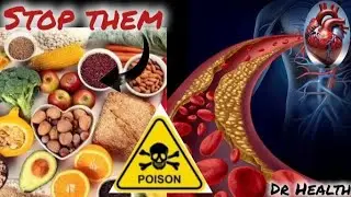 🛑10 Dangerous Foods That Silently Increase Cholesterol Live by Dr Health 2026