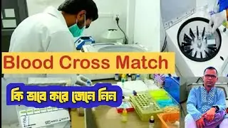 ক্রসম্যাচ কিভাবে  করা হয়,Crossmatching procedure  bangla tutorial