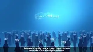Clear Aligners San Diego CA