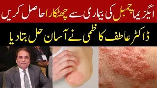 Eczema Relief in 7 Days I Dr Atif Kazmi Dermatologist ✨