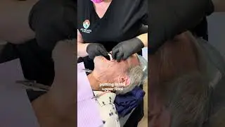 POV: You Just Got Your Permanent Smile!