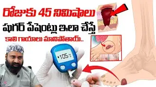 రోజుకు 45 నిమిషాలు షుగర్ పేషెంట్లు ఇలా చేస్తే : How To Treat Diabetic Foot Wounds | Diabetes
