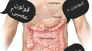 Coloverin علاج القولون و أنواعه #pharmacy #colon