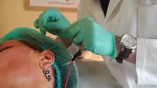 Needle shaping