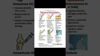 Types of injection
