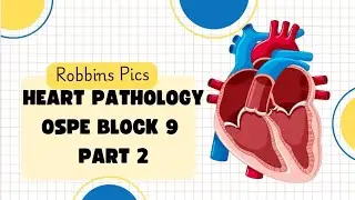 Heart Pathology Ospe Part 2 &bull; block 9 pathology Ospe 