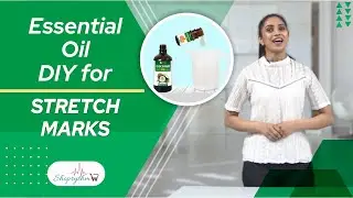 Essential oil DIY for Stretch Marks | How to remove stretch marks using Essential Oils?