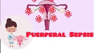 Puerperal Sepsis/ Postpartum Infection