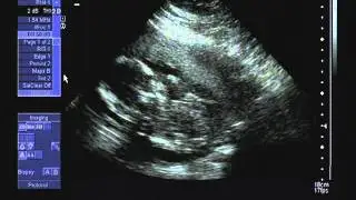 Henry Michael Harris