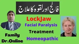 Lock Jaw / Facial Paralyses / Tetanus / Laqva  Treatment in Homeopathic