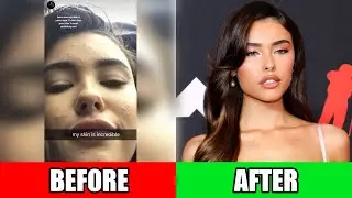 Madison Beer&rsquo;s Tanning & Skincare Routine: Get Her Natural Sun-Kissed Glow!