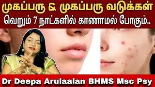 முகப்பருவினால் அவதியா?கவலைய விடுங்க | முகப்பரு & வடுக்கள் நீங்க முகத்தில் இதை பூசினால் போதும்.. #ssc