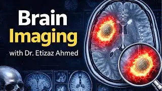 Brain Imaging with Dr  Etizaz Ahmed | The Neurosurgical Case Room
