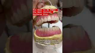 Too Real to Be Fake! The Most Natural Dentures Ever #dentures #dentist #orthodontist #shortvideo