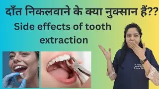 हमें दांत क्यूँ नहीं निकलवाना चाहिए??Tooth removal |