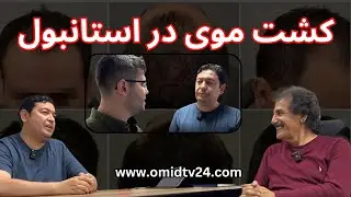 کشت موی در استانبول  - Hair transplant in Istanbul