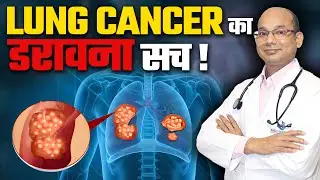 Lung cancer Signs and Symptoms | जिसे लोग नज़रअंदाज़ कर देते हैं! | Felix Hospital