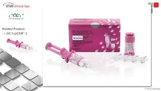 Dr. Sam Simos on GC FujiCEM 2