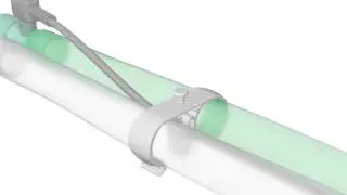 Tube Management Programme from Intersurgical