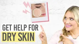 🌵☀️ Сухая кожа? Вот как это исправить! 🔧✨