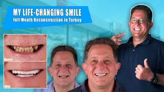 Full Mouth Reconstruction with Implants & Crowns in Turkey Does it REALLY Work?