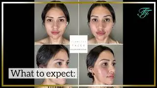 DiamondGlow Facial in Chandler AZ - Flawless Faces MedSpa Chandler