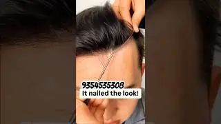 guss Frontline hair patch #shorts #trending #viral