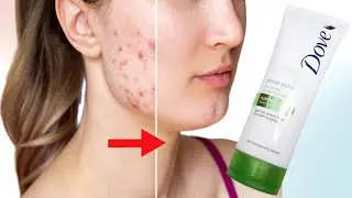 Dove oil control deep pure facial cleanser | Dove Face Wash for Oily and Acne-Prone Skin