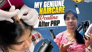 My Hair Care Routine After PRP Treatment | Tips for Healthy Hair Growth #haircare #hair