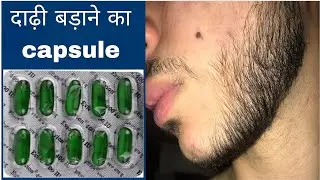 Dadhi kaise badhaye | how to grow a beard 