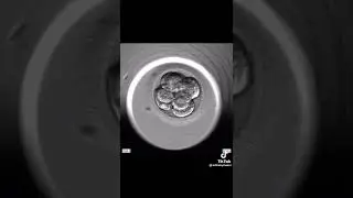 This is how pre-implantation genetic testing works | @ivf.babymaker