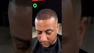 Balding to full head of hair in minutes! 😏🔥
