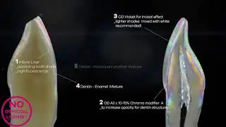 Dental Restoration [Training with INSYNC ZR]