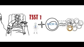 Staphylococcus aureus, USMLE step 1, USMLE step 2, sindrome de choque toxico, TSST 1.