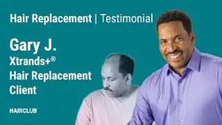 Gary  | Non-surgical hair replacement for African-American Males
